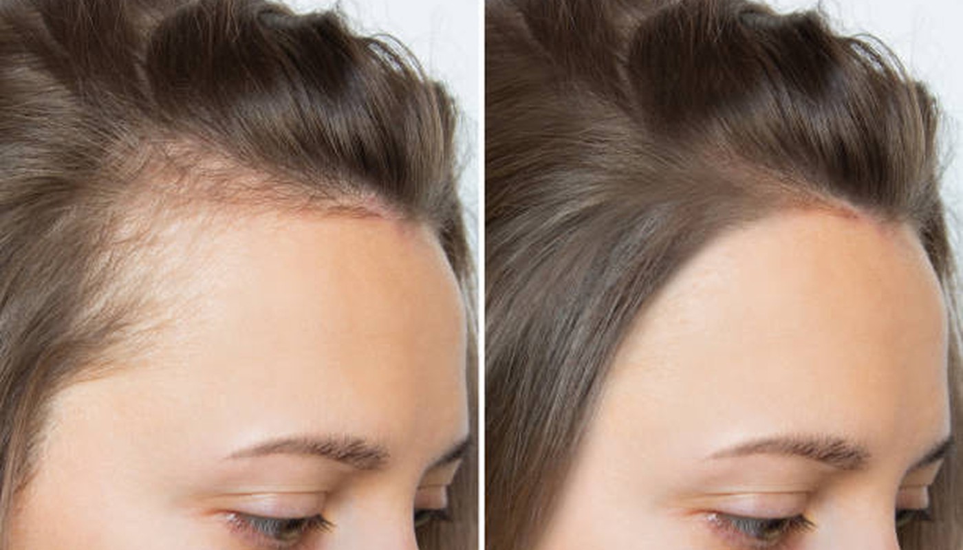 Why Hair Feels Thin And Weak
